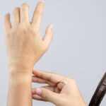 How To Remove Dead Skin From Watch Band | 5 Proven Methods